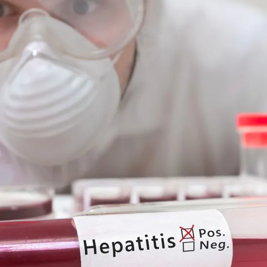 hepatitis b core antibody igm test